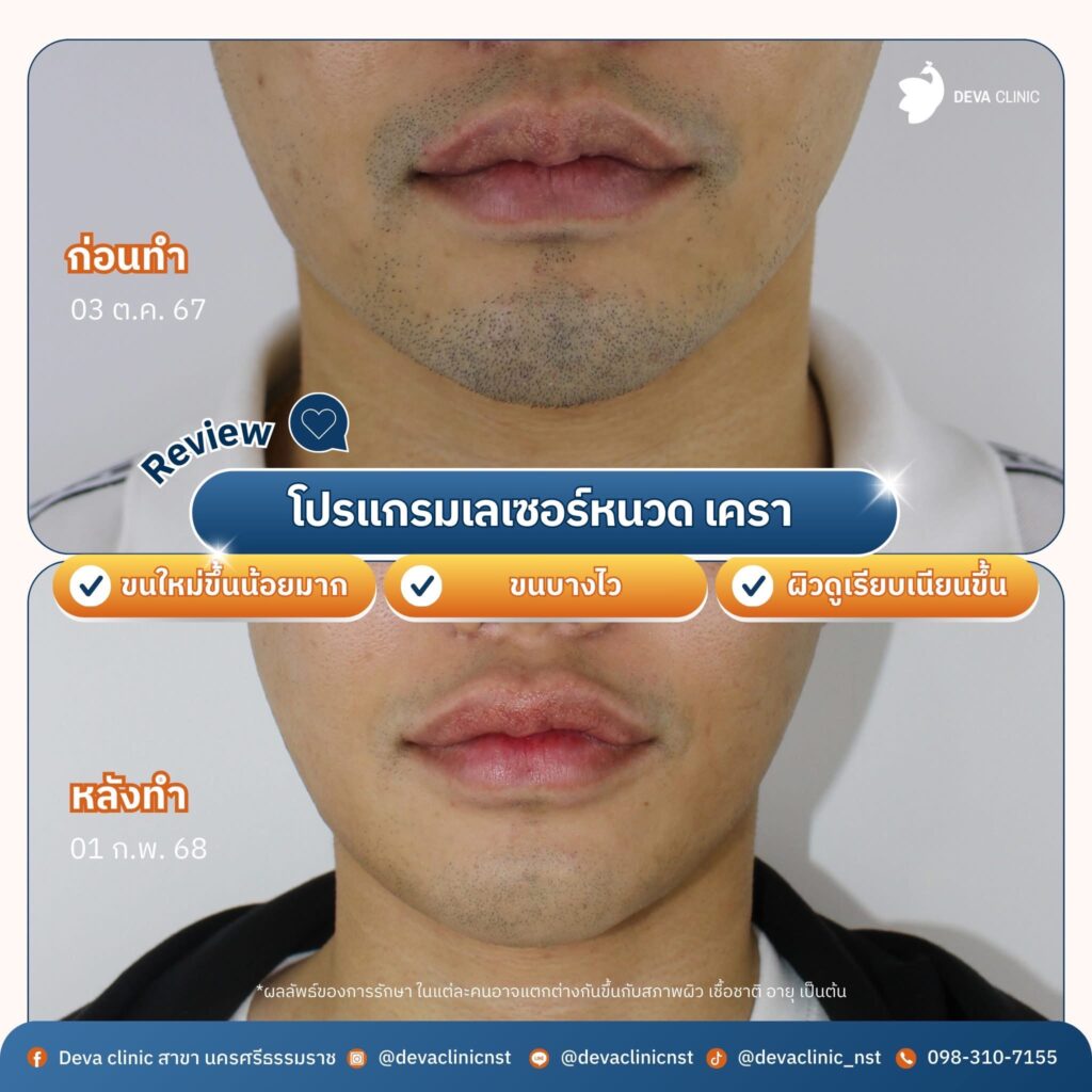 lp หนวด เครา 1