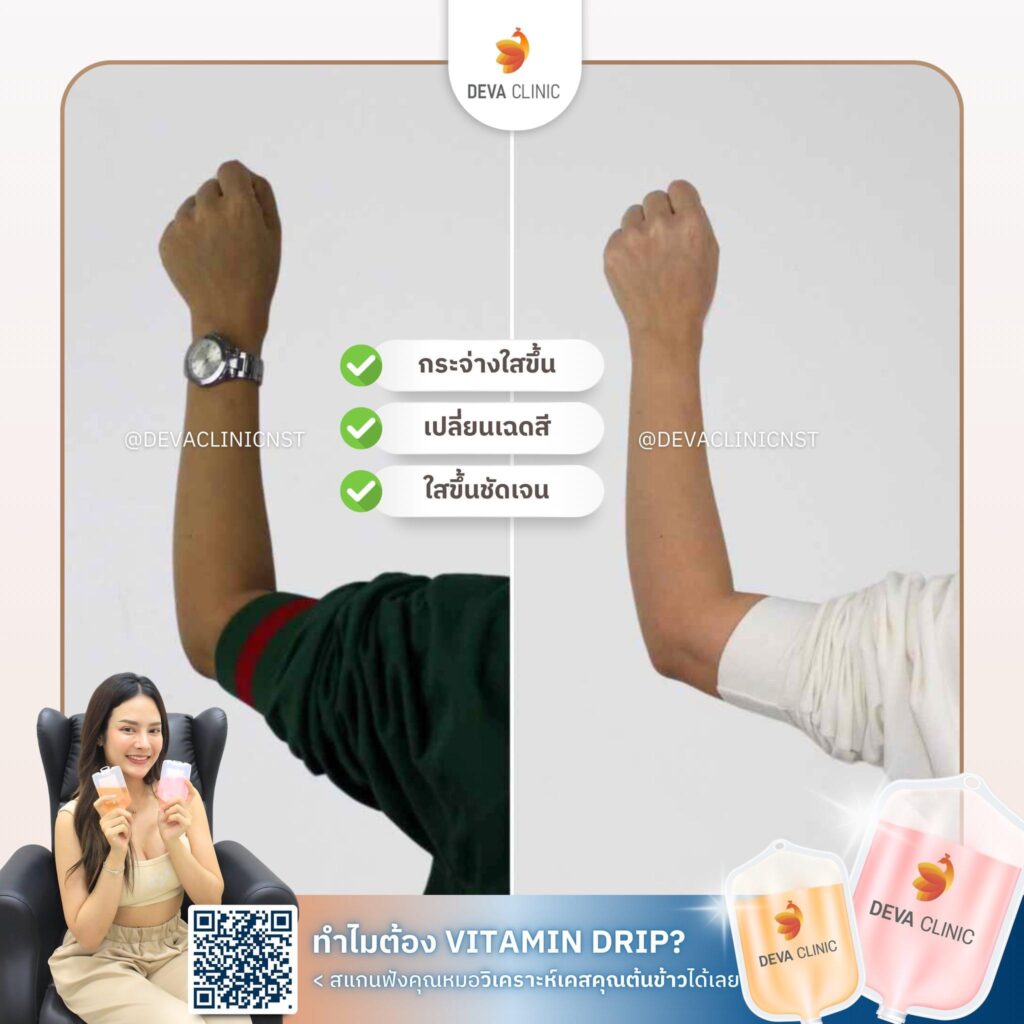 วิตามินผิว 4