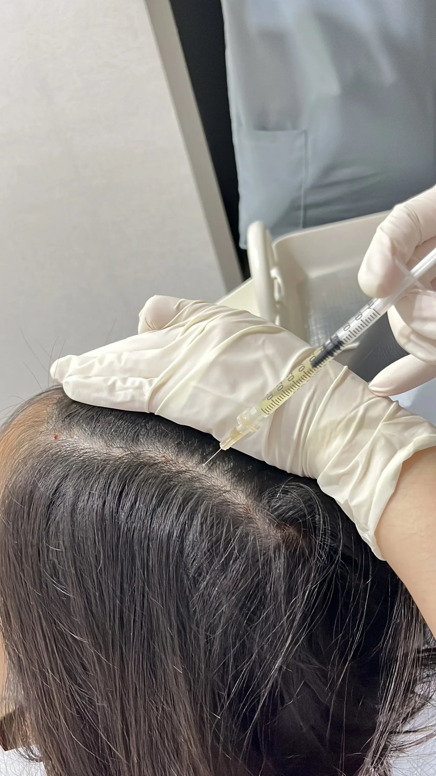 hair growth factor 4