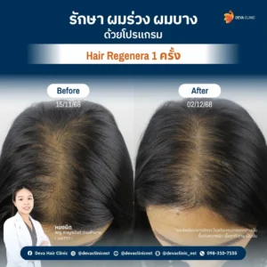 hair regenera7